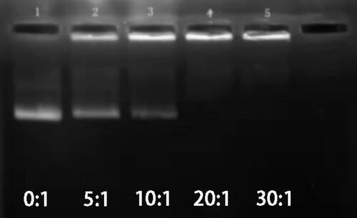Figure 5 Image of agarose gel electro-phoresis of plasmid DNA and complexed with PEI- Mn0.5 Zn0.5Fe2O4 (Lane1-5(PEI-MZF/DNA w/w): 0:1; 5:1; 10:1; 20:1; 30:1).