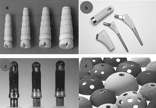 Figure 1. (a) Alumina-coated dental implants [Citation15], (b) Hydroxyapatite-coated hip prosthesis [Citation16], (c) Bio-glass coated Titanium dental implant [Citation17] and (d) Plasma-sprayed ceramic coated acetabular cups [Citation18].