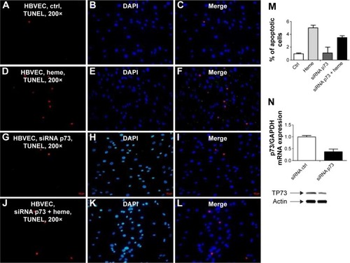 Figure 5 Silencing of p73 by siRNA protects HBVECs from heme-induced apoptosis as measured by TUNEL assay.