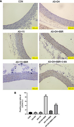 Figure 4 LC3-II protein expression in the rat aortic tissues. (A) Immunohistochemical test LC3-II (200×; n = 5). (B) LC3-II protein positive area ratio (n = 5).