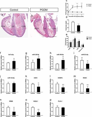 Figure 5. Validation of hub miRNAs and genes in the fetal heart of the control and PGDM groups. (a-b) H&E staining of E18.5 mouse heart vertical sections in the control (a) and PGDM (b) groups. (c) The detection of mouse maternal glucose blood in weeks 0–3. (d) The weight of fetuses in the control and PGDM groups at E18.5. (e) Quantification of the thicknesses of the RVW, VS, LVW and trabeculae of mouse hearts in the control and PGDM groups at E18.5. (f-p) Validation of hub miRNAs and genes in the fetal hearts of the control and PGDM groups using quantitative real-time PCR. Scale bars = 400 μm. *p < 0.05, **p < 0.01, ***p < 0.001