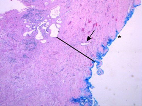 Figure 2 H&E staining.