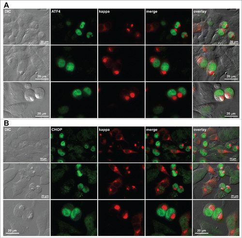 Figure 11. Upregulation and nuclear accumulation of PERK downstream effectors ATF4 and CHOP in Russell body-positive cells. Fluorescent micrographs of HEK293 cells transfected with N35W variant LC construct. On day-2 post transfection, suspension cultured cells were seeded onto poly-lysine coated glass coverslips and statically incubated for 24 hr. On day-3, cells were fixed, permeabilized, and co-stained with Texas Red-conjugated anti-kappa polyclonal antibody and specific antibodies against ATF4 (A) and CHOP (B). Green and red image fields were superimposed to create ‘merge’ views. DIC and ‘merge’ were superimposed to generate ‘overlay’ views.