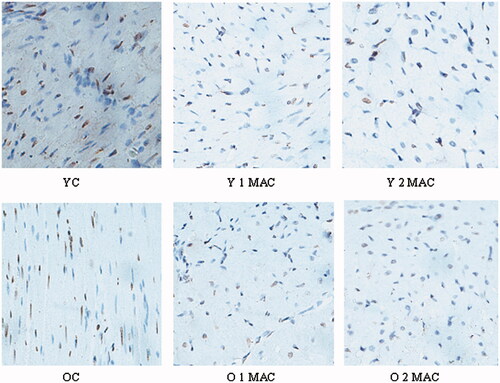 Figure 3. Representative images of TUNEL-stained apoptotic nuclei in brown and non-apoptotic nuclei in blue in different groups. In each group, six hearts were used. YC: young control; Y 1 MAC: young 1 MAC sevoflurane postconditioning; Y 2 MAC: young 2 MAC sevoflurane postconditioning; OC: old control; O 1 MAC: old 1 MAC sevoflurane postconditioning; O 2 MAC: old 2 MAC sevoflurane postconditioning; MAC: minimum alveolar concentration.