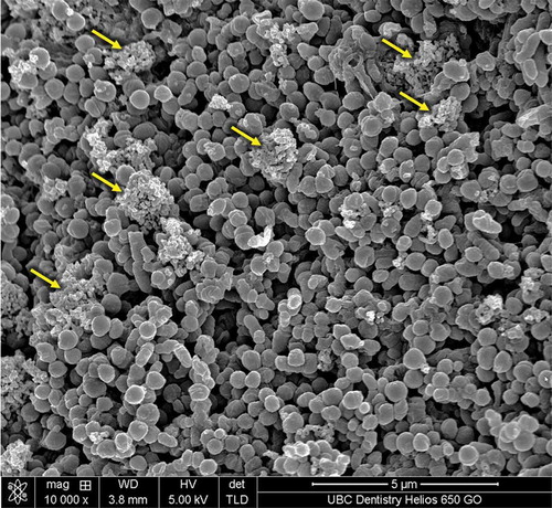 Figure 2. SEM image of plaque biofilm treated by chlorhexidine. Debris from the killed cells has accumulated to the biofilm surface (arrow).