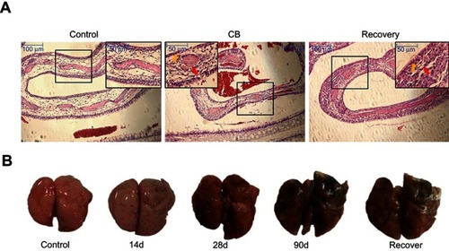 Figure 3 Images of the turbinate bone and the lung in rats. (A) Representative photomicrograph of pathological changes in the turbinate bone in rats. (HE staining, 100×, 200×). The red arrows indicate atrophy or thinning of the olfactory epithelium. The yellow arrows indicate inflammation cells. (B) Images of lungs.Abbreviation: CB, Carbon black.