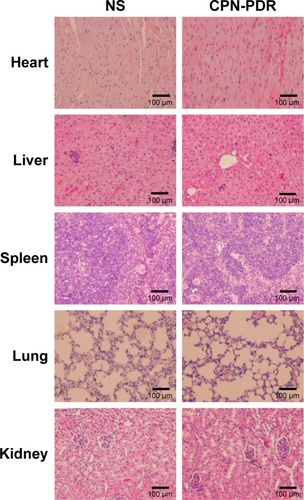 Figure 7 Results of histological assessment (×100), scale bars =100 µm.Abbreviations: NS, normal saline; CMCS, o-carboxymethyl-chitosan; PEG, poly (ethylene glycol); NGR, aspargine-glycine-arginine peptide; CPN, CMCS-PEG-NGR; CPN-PDR, CPN-coated Dox and siRNA co-loaded nanoparticles.
