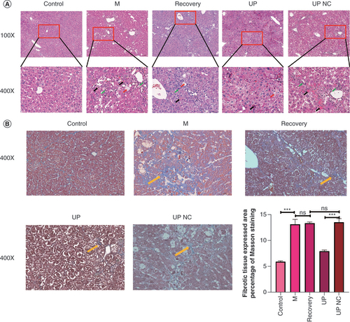 Figure 2. Pathological results in mouse liver. (A) Hematoxylin and eosin staining: fibrous hyperplasia (green arrow), hepatocyte feathery degeneration (red arrow), hepatocyte necrosis (black arrow). (B) Masson stain: fibrous expression (yellow arrow).***p < 0.001.