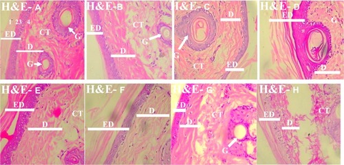 Figure 1 Photomicrograph of the skin of the experimental animals in Groups A–H, demonstrating the skin using H and E (H&E A-H; X400). The stratum corneum was disrupted in Groups B, D, and G (H&E B, D, and G).