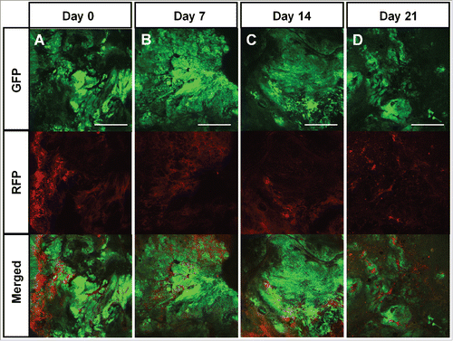 Figure 3. Color-coded real-time intravital cancer-cell/stroma-cell imaging after treatment with a TGF-β inhibitor. Color-coded tumor from a TGF-β inhibitor-treated mouse (A-D). Upper panels show GFP-expressing cancer cells; middle panels show RFP-expressing stromal cells, and lower panels show merged images with GFP and RFP. Scale bars: 1.0 mm.