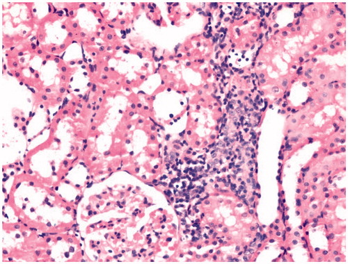 Figure 4. Minimal inflammation findings in kidney tissue of the pneumoperitoneum + theophylline group (HE ×400).