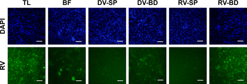 Figure S1 Recovery of infectious rotavirus adsorbed onto the antibody-integrated MNBs.Notes: Rotavirus-infected cell lysate (10 µL) was diluted with PBS (500 µL) and then incubated with antibody-integrated MNBs. Fractions are as follows: 1) diluted rotavirus sample before incubation with the beads (BF), 2) bead fraction after incubation with anti-rotavirus antibody-integrated MNBs (RV-BD), 3) bead fraction after incubation with anti-dengue virus antibody-integrated MNBs (DV-BD), 4) supernatant fraction after incubation with the anti-rotavirus antibody-integrated MNBs (RV-SP), 5) supernatant fraction after incubation with the anti-dengue virus antibody-integrated MNBs (DV-SP), and 6) total sample containing the same quantity of rotavirus as in 10 µL of rotavirus-infected cell lysate (total fraction, TL). The fractions were added to MA104 cells, which were then cultured for 1 day. The cells were fixed with glutaraldehyde and analyzed by an IFA using anti-rotavirus antibody and DAPI solution, as described in Materials and methods. Representative fluorescence images for rotavirus (Green) (exposure time 5 seconds) and DAPI staining (Blue) (exposure time: 0.5 seconds) are shown. Scale bar=50 µm.Abbreviations: DAPI, 4′,6-diamidino-2-phenylindole; IFA, indirect fluorescent assay; MNBs, magnetic nanobeads; RV, rotavirus.