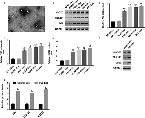 Figure 1. Alix, TSG101 and HSC70 protein levels were upregulated in exosomes derived from PCa cells and PCa patient serum. (a) Electron microscopic images of exosomes isolated from PCa cells. (b-e) The protein levels of Alix, TSG101 and HSC70 in the exosomes of normal prostatic epithelial cells (BPH1 and RWPE1) and PCa cells (VCap and LNCap, DU145, PC3) were determined by Western blot assay. *P < 0.05 compared with BPH1-Exo; #P < 0.05 compared with RWPE1-Exo group. (f and g) The protein levels of Alix, TSG101 and HSC70 were measured in the exosomes derived from serum of healthy volunteers (n = 10) and PCa patients (n = 10) with Western blot assay. *P < 0.05 compared with normal-Exo group. N = 10, data were expressed as mean ± SEM; Student’s t test or one-way ANOVA was used for analyzing data