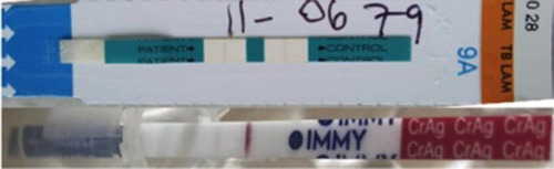 Figure 1 LAM TB (upper) and cryptococcal antigen test (lower) results.