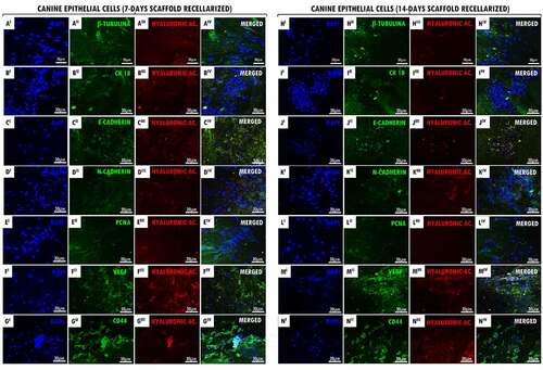 Figure 1. Recellularized canine trachea scaffolds immunofluorescence with EpC cells (7 and 14 days). In (AI – NI), DAPI immunostaining (blue) for canine tracheal epithelial cell nuclei. In (AII – NII), immunostaining (green) for antibodies: β-Tubulin, CK18, E-Cadherin, N-Cadherin, PCNA, VEGF, CD44, respectively. In (AIII – NIII), hyaluronic acid immunostaining (red) for the canine trachea ECM. In (AIV- NIV), merged. Scale bar: 30 µm.