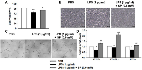 Figure 4 SP blocks LPS-evoked cell injury and the dysregulated angiogenesis in HPMECs. HPMECs were stimulated with LPS (1 μg/mL) for 2 h, followed by treated with SP (0.6 mM) for 24 h. (A) Cell viability was determined using the CCK-8 assay. (B) Representative cell morphology images. (C) Tube formation of HPMECs. (D) The mRNA levels of VEGFA, VEGFR1 and HIF-1α. *P<0.05 vs PBS; **P<0.01 vs PBS; ***P<0.001 vs PBS; #P<0.05 vs LPS; ##P<0.01 vs LPS; ###P<0.001 vs LPS. Values are mean±SE, n=3 per group.