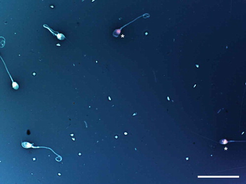 Figure 3. Sperm vitality assessment by one-step eosin-nigrosin staining technique. One-step eosin-nigrosin staining technique is used to detect the percentage of viability in a given sperm population. Eosin is used to mark dead cells which uptake the stain through damaged, porous membranes and appear red or pinkish (asterisk), where live spermatozoa that hinder eosin to penetrate head region because of their intact membrane, appear white. Nigrosin stains the background to increase the contrast between stained and unstained cells providing a dark contrast background. Eosin-nigrosin staining. Scale bar indicates 50 µm.