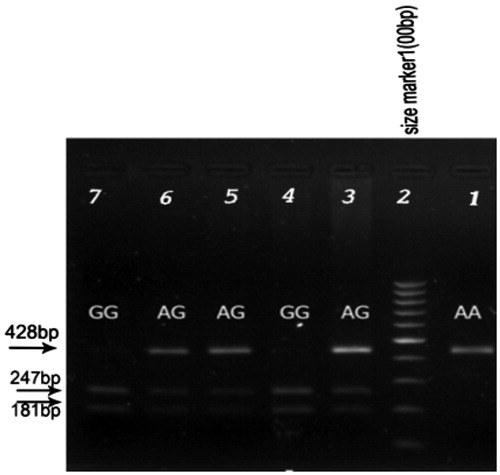 Figure 1. PCR-RFLP of the amplified segment in 1267HSP70-2 gene. The genotype was labelled on corresponding sequences and the sites which were marked with black arrows were the SNP of HSP70-2 gene. Electrophoresed on 1.5% agarose, stained with ethidium bromide. Lane 2, 100bp DNA ladder. Lane 3, 5 and 6 heterozygote for HSP70-2 genotype, Lane 4 and 7 homozygote GG for HSP70-2 genotype. Lane 1 homozygote AA for HSP70-2 genotype.