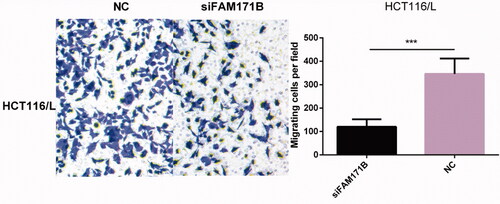 Figure 6. Effect of FAM171B knockdown on cell migration in HCT116/L. In vitro migration assay showed that knockdown of FAM171B weakened HCT116/L cell migration. ***p < .001 (Student’s t-test).
