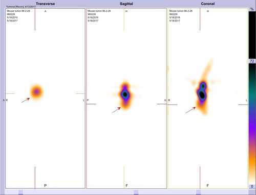 Figure 11 Transverse, sagittal and coronal imaging of nude mice bearing A549 tumor 1 hour after injection of 3.7 MBq of radiolabeled nanoconjugate. Arrows indicate the tumor position.