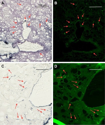 Figure 9 Uptake of AuNPs into brain microglia and astrocytes after injection of AuNPs directly into control brains (non-tumor).Notes: (A and C) Gold enhanced (gold stained, black); (B) fluorescence, anti-Iba-1 (microglia, green); and (D) fluorescence, anti-GFAP (astrocytes, green).Abbreviations: AuNPs, gold nanoparticles; GFAP, glial fibrillary acidic protein.