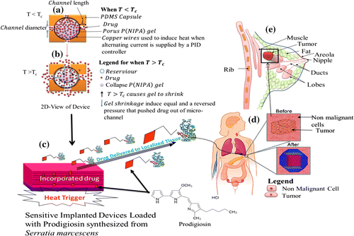 Figure 5. Schematic of How the Device Could be Used: (a) When the Device Temperature is Less Than the Lower Critical Solution Temperature (LCST) (T < LCST), Little or No Drug Will Be Released; (b) Drug Molecules Released from the Hydrogel when T ≥ LCST; (c) Heat Trigger Mechanism Causes Loaded Cancer Drugs to be Release from the Thermo-sensitive Hydrogel; (d) Implanted Device at tumor location, and (e) Schematic of a Female Breast Containing Solid tumor.