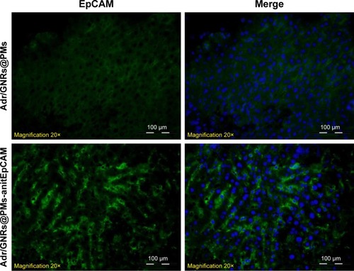 Figure 4 Identification of binary bomb-EpCAM tumor tissues of mice.Notes: Blue: DAPI-positive staining of nuclei in the spheroid. Green: positive staining of antiEpCAM which were labeled Adr/GNRs@PMs.Abbreviations: Adr, Adriamycin; EpCAM, epithelial cell adhesion molecule; GNR, gold nanorod; PM, polymeric nanomicelles.