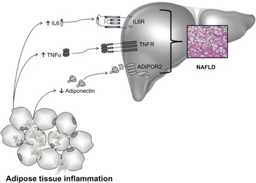 Figure 4 Cytokines and NAFLD.