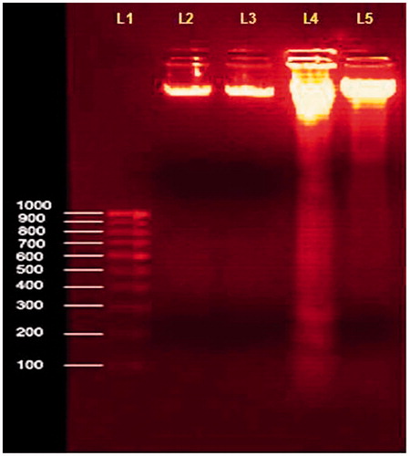 Figure 10. Changes in the DNA fragmentation assay in cultured lymphocytes on pretreatment with ethanol extract of MA. Values are given as mean ± SD of six replicates in each group. Lane (L1)-1000bP ladder DNA; L2-Normal lymphocytes; L3-Normal + MA (60 µg/mL); L4-H2O2 (500 µM); L5-H2O2 + MA (60 µg/mL).