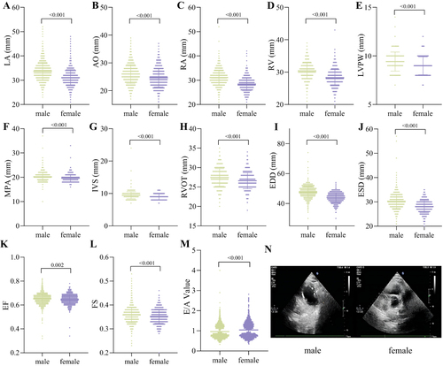 Figure 5 Comparison of cardiac ultrasound parameters between male and female participants. (A) LA. (B) AO. (C) RA. (D) RV. (E) LVPW. (F) MPA. (G) IVS. (H) RVOT. (I) EDD. (J) ESD. (K) EF. (L) FS. (M) E/A Value. (N) Representative cardiac ultrasound images.