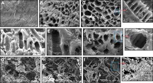 Figure 1 Scanning electron microscopy.Notes: (A) Raw date pits; (B and C) date-pit activated carbon; (D–F) jojoba-seed activated carbon; and (G–I) microalgae activated carbon.