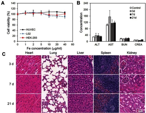 Figure 4 Cytotoxicity and in vivo toxicology.Notes: (A) In vitro cell viability of HUVEC, L02 and HEK-293 cells after incubation with various concentrations of SPIO/DSPE-PEG5k-(Bom&Cy5) nanomicelles for 24 hrs. (B) Serum biochemistry data on ALT, AST, BUN and CREA. (C) Micrographs of H&E-stained organ slices (heart, lung, liver, spleen and kidney) from mice 3 days, 7 days and 21 days after intravenous injection of SPIO/DSPE-PEG5k-(Bom&Cy5) nanomicelles (H&E staining, 40×). Scale bar =50 µm.Abbreviations: SPIO, superparamagnetic iron oxide; ALT, alanine aminotransferase; AST, aspartate aminotransferase; BUN, blood urea nitrogen; CREA, creatinine.