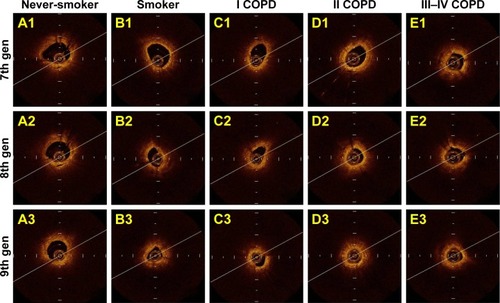 Figure 2 Cross-sectional endobronchial optical coherence tomography (EB-OCT) images of the seventh, eighth, and ninth generation of bronchi.
