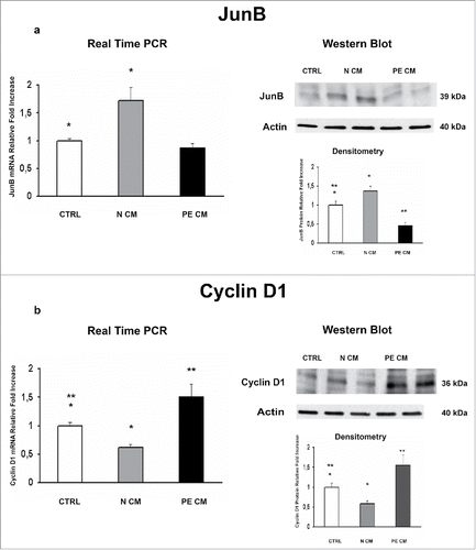 Figure 4. JunB and Cyclin D1 gene and protein expression levels in physiological placental villous explants treated with culture media conditioned by normal or PE-PDMSC. (A)JunB mRNA (left panels) and protein (right panels) expression levels in physiological villous explants treated with unconditioned media (CTRL, n = 16 explants) or media conditioned by normal (N CM, n = 16 explants) and preeclamptic (PE CM, n = 16 explants) PDMSCs as assessed by Real Time PCR and Western Blot analysis. B) Cyclin D1 mRNA (left panels) and protein (right panels) expression levels in physiological villous explants treated with unconditioned media (CTRL, n = 16 explants) or media conditioned by normal (N CM, n = 16 explants) and preeclamptic (PE CM, n = 16 explants) PDMSCs as assessed by Real Time PCR and Western Blot analysis. Statistical significance (*) has been considered as p < 0.05.