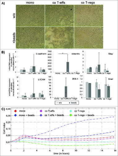Figure 6. (See previous page). Activated CD4+ T-effs induce EMT and increase cell invasion in T3M4 cells. (A) Representative images (n = 3 experiments with T cells isolated from three individual donors) showing cell morphology of T3M4 cells monocultured (mono) or directly co-cultured with T-effs (co T-effs) or T-regs (co T-regs) for 72 h, either in the absence (w/o) or presence of activation beads (beads). Magnification x 280. (B) E-cadherin, L1CAM, vimentin, ZEB-1, Snail and Slug expression were analyzed by RT-qPCR in the differentially cultured T3M4 cells. TBP was used as house-keeping gene for control. Data represent the median values with quartiles (Q0,75 as upper, Q0.25 as lower deviation) of four independent experiments with T cells isolated from four individual donors. * = p < 0.05. (C) Cell invasion of T3M4 cells was determined in an xCelligence Real time Analyzer with collagen-I coated transwells after 24 h. Since maximum cell invasion was reached after 16 h, cell invasion of mono- and co-cultured T3M4 cells presented as cell indices determined over a time period of 16 h. One representative invasion assay from three independent experiments with T cells isolated from three individual donors is shown.