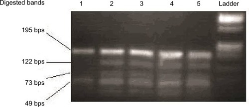 Figure 1 Agarose gel electrophoresis for restriction enzyme assay by DraI showed that case no 1 had an absent 122 bps fragment, indicating that DAZ1/2 were deleted.