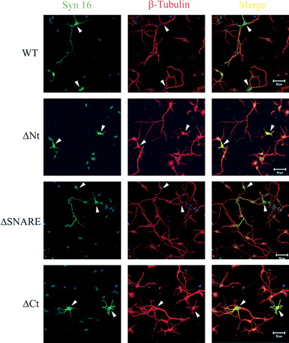 Figure S2.  Over-expression of Syn 16 wild type and mutants did not disrupt β-tubulin staining. Primary cortical neurons transfected at 3DIV and fixed at 7DIV were labeled for Syn 16 (FITC, green) and β-tubulin (Texas Red, red). β-tubulin staining is not diminished in cells over-expressing either wild type Syn 16 (WT) or the other mutant constructs (arrowheads). Scale bar = 50 µm.