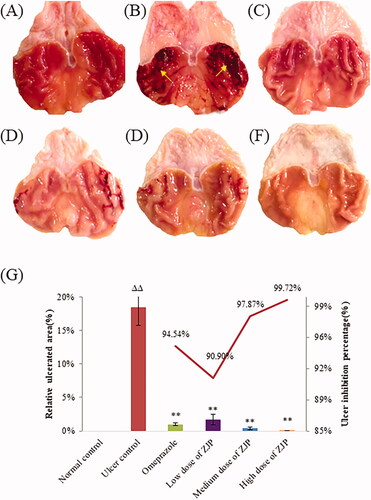 Figure 9. Protective effects of ZJP on the gastric mucosa evaluated by photos of the stomach: (A) normal control group, (B) ulcer control group (yellow arrows: submucosal haemorrhagic stripes), (C) omeprazole group, (D) low dose of ZJP group; (E) medium dose of ZJP group; (F) high dose of ZJP group and (G) the relative ulcerated area and ulcer inhibition percentage of various experimental groups. Δ: comparing with the normal control group, *: comparing with the ulcer control group.