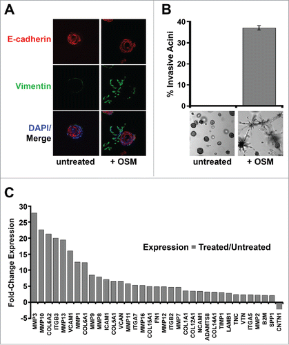 Figure 6. Constitutive MYC expression dismantles STAT3/SMAD3-induced senescence and cooperates with OSM to drive invasiveness. Shp53/MYC-HMEC were plated in 3D laminin-rich basement membrane (matrigel) culture in the presence and absence of recombinant OSM for 10 d. (A) Immunofluorescence using confocal microscopy at 100X magnification with Alexafluor-conjugated antibodies directed against E-cadherin (red) or Vimentin (green) and DAPI stain (blue, nuclear stain). (B) Invasive acini were photographed and quantified by brightfield microscopy at 5X magnification. (C) Following OSM-treatment, mRNA was harvested from shp53/MYC-HMEC after extraction from 3D matrigel culture and then subjected to a targeted Extracellular Matrix (ECM) and Adhesion Molecules qRT-PCR profiler array to compare gene expression differences between untreated and OSM-treated cells.