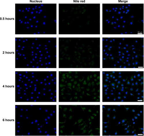 Figure 7 Nile red uptake.Notes: SKOV3 cells were seeded on glass coverslips in 35 mm culture dishes. After 24 hours, cells were washed and treated with medium containing 0.5 μM nile red or equivalent concentration of nile red-loaded micelles. Nile red images were pseudo-colored green and merged with Hoechst 33342 images. Scale bars =50 μm.