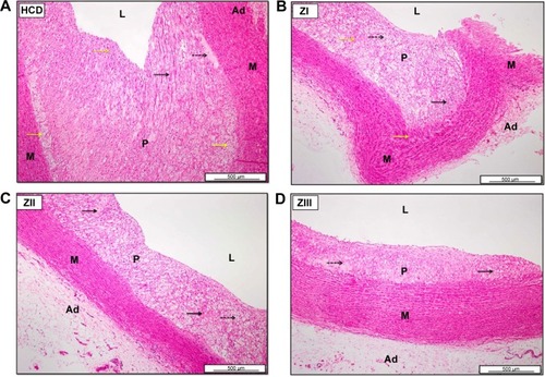 Figure 24 Photomicrographs of aortas from HCD (A), ZI (B), ZII (C), and ZIII (D) groups.