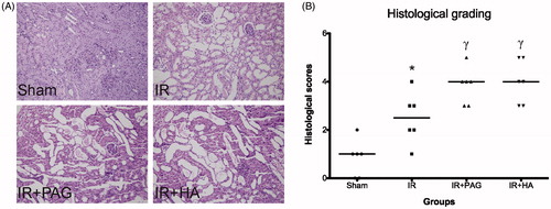 Figure 3. Histological evaluation of kidneys after IRI. (A) Representative histological photographs of kidney tissues from different groups. (B) Detailed histological scores of each group. Notes: Data shown are individual values and medians; *statistically significant from sham group (p < 0.05); γstatistically significant from IR group (p < 0.05); n = 6 each.