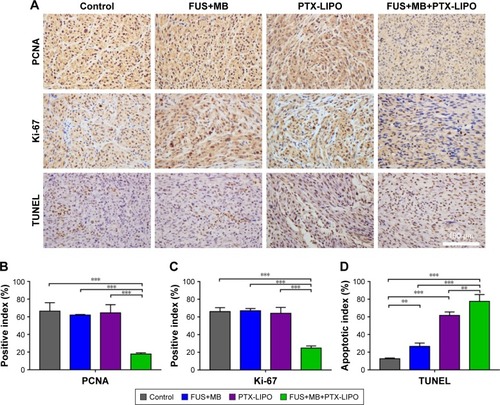 Figure 9 Proliferation and apoptosis analysis of glioblastoma in nude mice receiving different treatments: no treatment as the Control, FUS exposure with MBs but without PTX-LIPO as FUS+MB, PTX-LIPO injection only and PTX-LIPO delivery using FUS with MBs as FUS+MB+PTX-LIPO.Notes: (A) Representative immunohistochemical staining of glioma sections against PCNA and Ki-67 and for the TUNEL assay. Cell nuclei were counterstained with hematoxylin. Glioma tissue was sampled 48 h after the treatment. Bar: 100 µm. Quantitative analysis of (B) PCNA-positive and (C) Ki-67-positive cells in the tumor region. The positive index was determined from the percentage of positive cells out of at least 2,000 tumor cells observed at 200× magnification. (D) Apoptosis quantification assessed by the percentage of TUNEL-positive cells in the glioma region. **P<0.01 and ***P<0.001.Abbreviations: FUS, focused ultrasound; MBs, microbubbles; PTX-LIPO, paclitaxel liposomes; TUNEL, terminal dexynucleotidyl transferase-mediated dUTP nick end labeling.