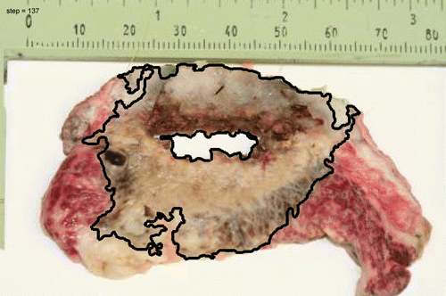 Figure 9. TTC staining of a section taken from the centre of the ablated cavity shown in Figure 8. The black line is the calculated contour of the ablated zone.