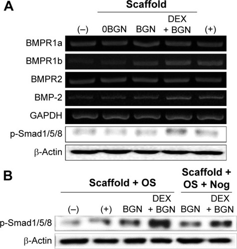 Figure 6 BMP-2 signaling pathway analyses.Notes: (A) mRNA levels of BMP receptors (R1a, R1b, and R2) and BMP-2, as well as the protein expression of p-Smad1/5/8. (B) Inhibition study to verify the signaling pathway, where a BMP inhibitor, Noggin (10 µg/mL) was used to treat the cells for 1 hour, and then cultured for 2 days before Western blot analysis. Data are representative of three independent experiments.Abbreviations: BMP, bone morphogenetic protein; BGN, bioactive glass nanoparticle; DEX, dexamethasone; GAPDH, glyceraldehyde 3-phosphate dehydrogenase; Nog, noggin.