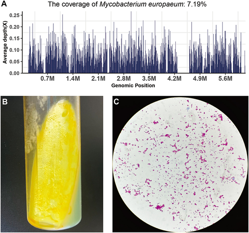 Figure 5 The microbiological tests of Mycobacterium europaeum. (A) Metagenomic next-generation sequencing results of patient. 6757 M. europaeum specific sequences covered 7.19% of the total M. europaeum genome, which was detected by mNGS in the BLAF sample; the BALF culture (B) and acid-fast bacilli (AFB) smears (C) of the M. europaeum.