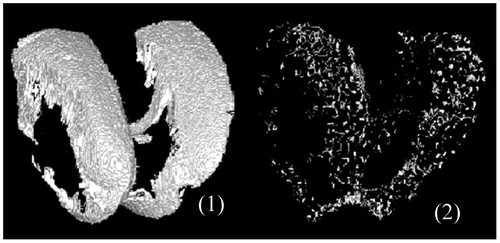 Figure 2. 3D representation of SMZ mask (1) and vascular porosity within SMZ (2).