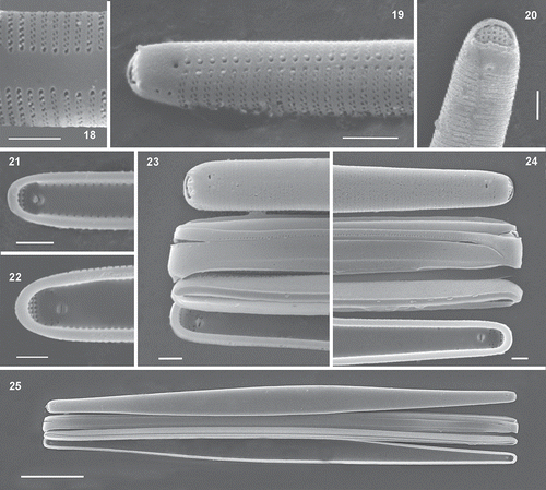 Figs 18–25. Scanning electron micrographs of Hyalosynedra lanceolata sp. nov. Fig. 18. Detail of the biseriate striation with alternate areolae and the lanceolate sternum at the centre of valves (up to one-third total width). Fig. 19. Apical part of cells showing areolae and a thin sternum. Fig. 20. Detail of the external openings of rimoportula and the rows of pores in ocellolimbus. Figs 21–22. Internal view of the smooth valves showing small rounded pores on both sides and the aperture of rimoportulae. Figs 23–24. Detail of valvocopula, copula and pleura with a row of pores (one apex in each image). Fig. 25. Cingular view of cells with the three girdle bands. Scale: Figs 18–24 = 1 µm, Fig. 25 = 10 µm.
