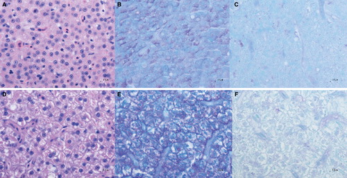 Figure 3. Liver of P. promelas treated with hydroxylated fullerenes showing hepatocyte morphology (A–C); liver of P. promelas from the control group showing normal hepatocyte morphology (D–F). Hepatocyte cytoplasm in hydroxylated fullerene-treated fish contains scant carbohydrate. Some of the intracytoplasmic material is glycogen, indicated by pink staining with periodic acid-Schiff reagent (B) and loss of this colouration after amylase treatment (C). Hepatocyte cytoplasm is pale with crystalline to clumped intracytoplasmic proteins in this female fish from the control group (D) with abundant intracytoplasmic glycogen (E, F). Haematoxylin and eosin (A, D), periodic acid-Schiff reagent (B, E) and periodic acid-Schiff with amylase pre-treatment (C, F). 1000× magnification.