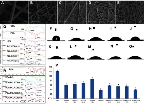 Figure 2 Composition analysis and hydrophilicity detection of nanofiber membranes. Scanning electron microscopic observation of PDA surface coating nanofiber membranes: (A) PDA-coated PCL, (B) PDA-coated PCL/COL (4:1), (C) PDA-coated PCL/COL (2:1), (D) PDA-coated PCL/COL (1:1), (E) PDA-coated PCL/COL (1:2), scale bars: 5 µm. Water contact angles of nanofiber membranes: (F) PCL, (G) PCL/COL (4:1), (H) PCL/COL (2:1), (I) PCL/COL (1:1), (J) PCL/COL (1:2), (K) PDA-coated PCL, (L) PDA-coated PCL/COL (4:1), (M) PDA-coated PCL/COL (2:1), (N) PDA-coated PCL/COL (1:1), (O) PDA-coated PCL/COL (1:2). (P) Statistical analysis of water contact angle values, *p＜0.05 compared with PCL group. (Q, R) Fourier-transform infrared analysis of nanofiber membranes.Abbreviations: PCL, polycaprolactone; COL, collagen; PDA, poly(dopamine).